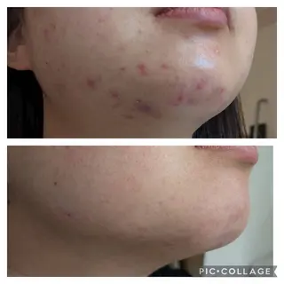 メナードフェイシャルサロン石山所属・メナードフェイシャル サロンmiyuのエステ・リラクイメージ