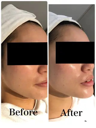 デ・アイム吹田サロン所属・垣内 賀奈子のエステ・リラクイメージ