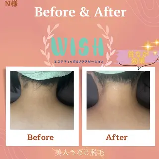 WISH 美肌脱毛のプロ！須藤のエステ・リラクイメージ