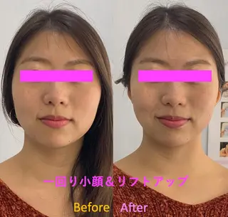 小顔美肌&痩身ｻﾛﾝ My Timeのエステ・リラクイメージ