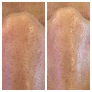 Blue Moon 【ブルームーン】のエステ・リラクイメージ