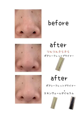 ⭐︎Naris⭐︎  Shiny所属・大阪市/大正区/ エステサロン/あさこのエステ・リラクイメージ