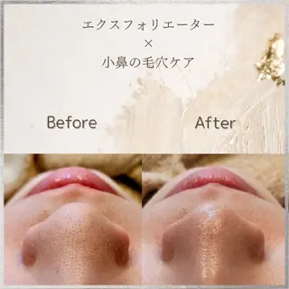 シェービングサロン アンダブル/鴨井のエステ・リラクイメージ