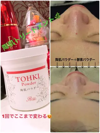 【リベルハーブピーリング認定店】敏感肌・美白脱毛専門店Dione立川店所属・Dione 立川店のエステ・リラクイメージ