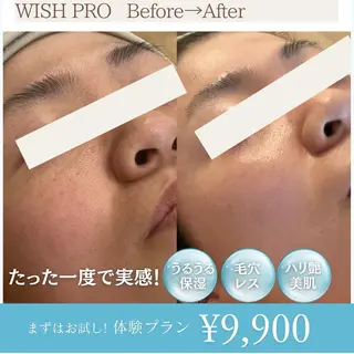 Total Beauty salon Bloom所属・肌質改善/ 脱毛/Bloomのエステ・リラクイメージ