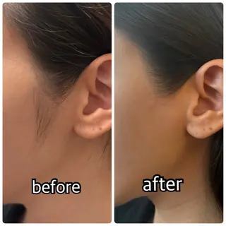 【横浜】アイリス エステティックのエステ・リラクイメージ