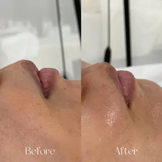 lazo MIYOのマツエク・マツパデザイン