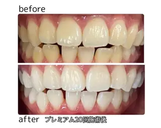 凛 リンのネイルデザイン