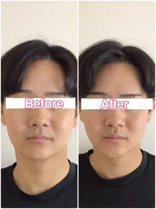 美容鍼・整体サロン アネモネ🌸心斎橋のエステ・リラクイメージ