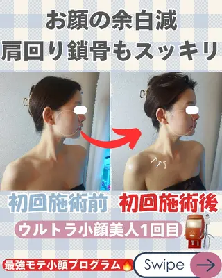 痩身ハーブピーリング 筋膜リリース☆B&Hのエステ・リラクイメージ