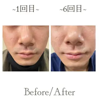 メンズサロンGRACE所属・salon GRACEのエステ・リラクイメージ