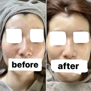 美肌脱毛&光フェイシャルサロン　ギュネシ所属・脱毛&光フェイシャル サロン　ギュネシのエステ・リラクイメージ