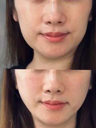 aliaハイフ&水光ジェットサロン所属・aliaハーブ水光店 エステティシャン募集のエステ・リラクイメージ