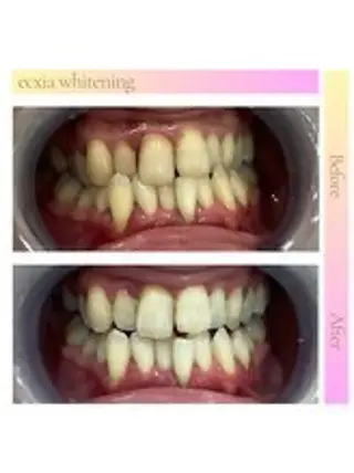 セルフホワイトニング エクシア西宮北口店所属・セルフホワイトニング エクシア西宮北口店のその他イメージ