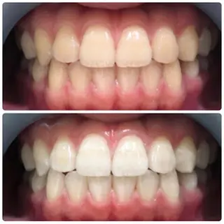 脱毛サロン ファインアートのエステ・リラクイメージ