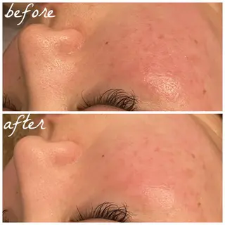 メンズ メナード岐阜市茜部 杉浦のエステ・リラクイメージ