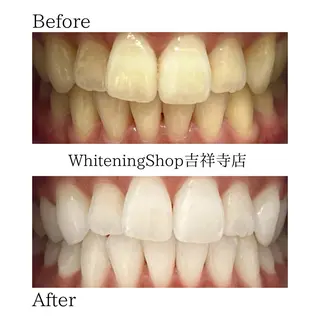 ホワイトニングショッ 吉祥寺2号店のエステ・リラクイメージ