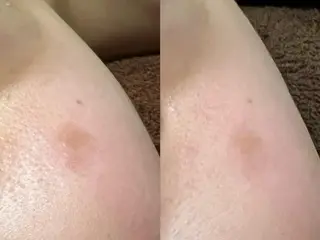 lymph care 'Welnəsのエステ・リラクイメージ