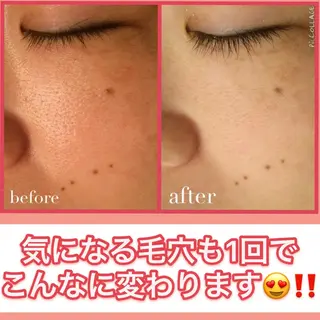 ミディアム カラー パーマ ヘアアレンジ メンズ キッズ ネイル マツエク・マツパ ニキビ・肌質改善専門 ♡人生が変わるサロンのエステ・リラクイメージ