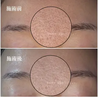 毛穴専門店アイミュー mamiのエステ・リラクイメージ