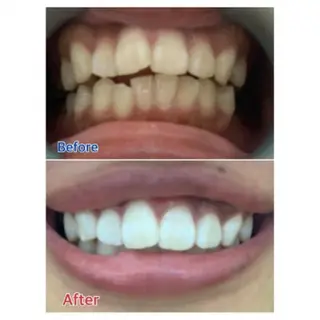 M渋谷店所属・Ｍ渋谷 ホワイトニングのエステ・リラクイメージ