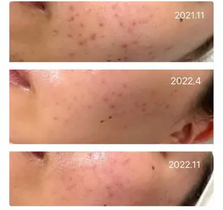 【堺市/泉ヶ丘駅】フェイシャルエステサロンSalon de jewel'm所属・Salon de jewel'm なおのエステ・リラクイメージ