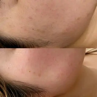 西脇 有紀のエステ・リラクイメージ