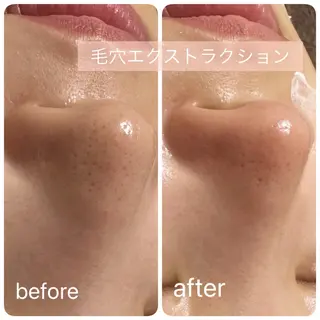 痩身Salon Charmeのエステ・リラクイメージ