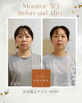 小顔美容矯正勝山式 shiroしろのエステ・リラクイメージ