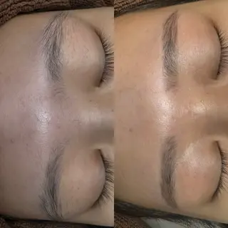 アイブロウ salonvilla所属・villa ☺︎草山 楓花のエステ・リラクイメージ