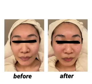 DeI'm   名古屋栄所属・小林 玲菜のエステ・リラクイメージ