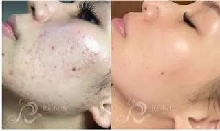 Eyelash Salon MAVIE所属・Eyelash MAVIEのマツエク・マツパデザイン