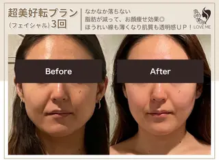 総合美容サロン LOVEME渋谷本店のエステ・リラクイメージ