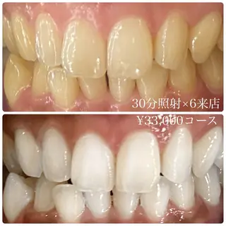 メンズ ホワイトニングルーム　川崎店所属・ホワイトニング ルーム　川崎店のその他イメージ