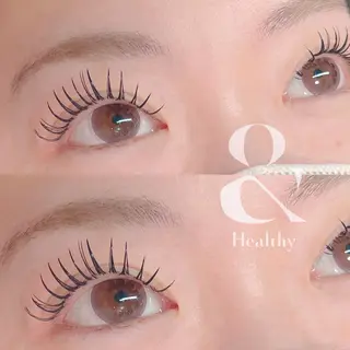 ใใใจใฏใปใใใ ๐๐ผ๐๐๐ ๐๐ธ๐โใฎใใใจใฏใปใใใใใถใคใณ