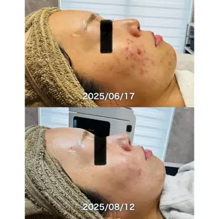 LukeBeauty salonのエステ・リラクイメージ