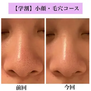 Bellesthe （ベルエステ）のエステ・リラクイメージ