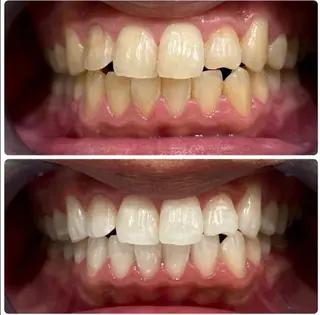 エクシアホワイト 立川南口のエステ・リラクイメージ