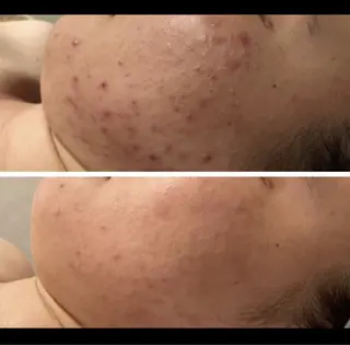 @ MINATOのエステ・リラクイメージ