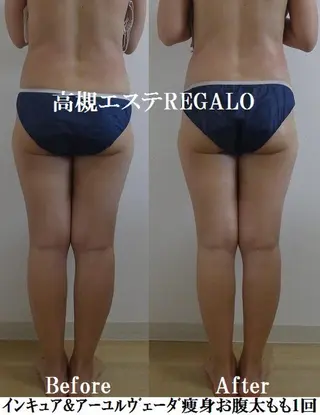 REGALO所属・矢野 さやかのエステ・リラクイメージ