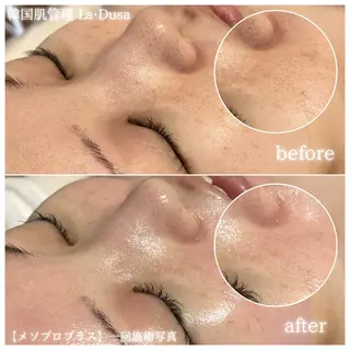 La Dusa 韓国肌管理/小波のエステ・リラクイメージ