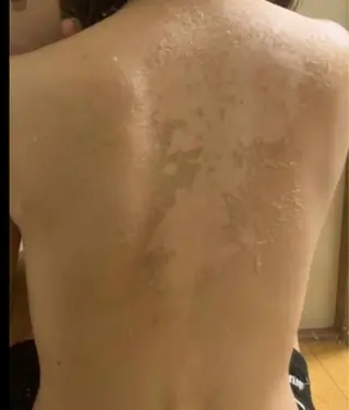 ☺ハーブピール💕 ソフィアカロン💖のエステ・リラクイメージ