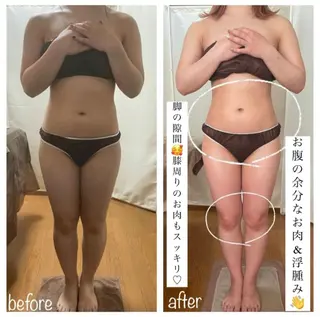 biloop所属・《痩身×疲労改善》 BILOOPのエステ・リラクイメージ