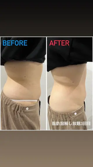 アルカンジュ~archange~所属・痩身/毛穴洗浄/脱毛 アルカンジュのエステ・リラクイメージ