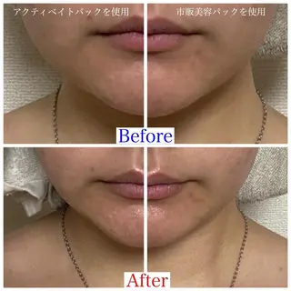 エステティックサロン La gemmeのマツエク・マツパデザイン