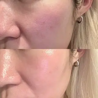 yosoy所属・yosoy 【ヨソイ】のマツエク・マツパデザイン