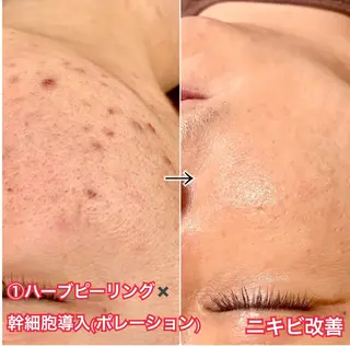 LAESSE 恵比寿所属・毛穴と美白の専門店 LAESSE 恵比寿のエステ・リラクイメージ