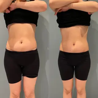 【大名】 NicoLのエステ・リラクイメージ