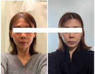 丸顔さんの救世主 高田 くみのエステ・リラクイメージ