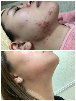 産後/ツヤ肌/子連れ /保育士在籍サロンのエステ・リラクイメージ